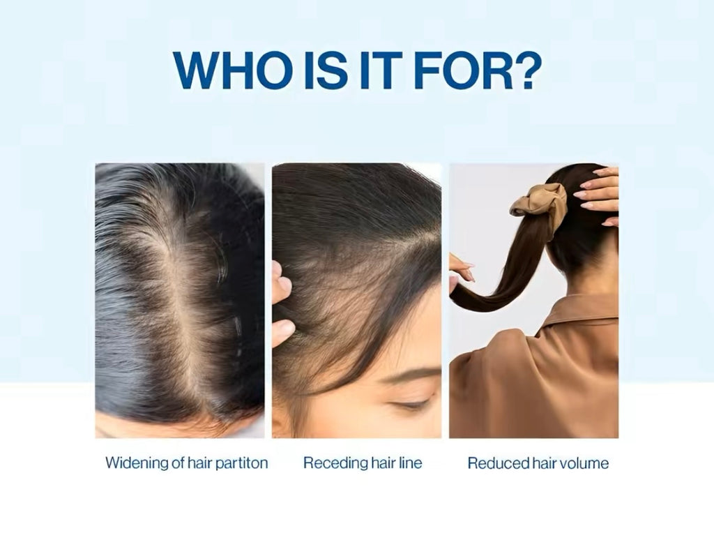 BeBodywise Rosemary Hair Care Essence Nourishing