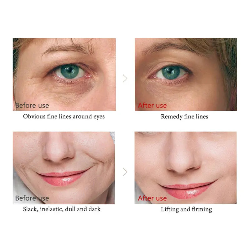 ARTISCARE 24k gold serum