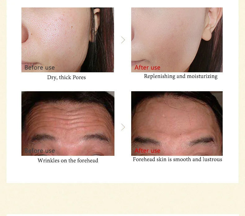 ARTISCARE 24k gold serum